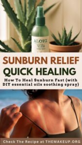 Heal Sunburn Fast